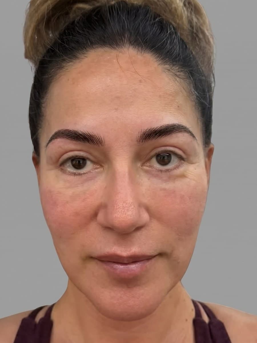 Susan K. after her brow transformation at Microblading LA