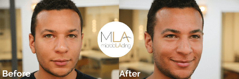 Microblading for Men Before and After Photo 4